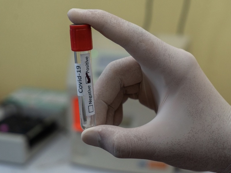 ข้อควรรู้ก่อนฉีดวัคซีนโควิด-19