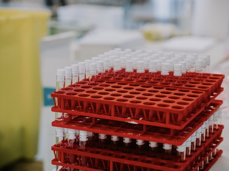 ข้อควรรู้ก่อนฉีดวัคซีนโควิด-19